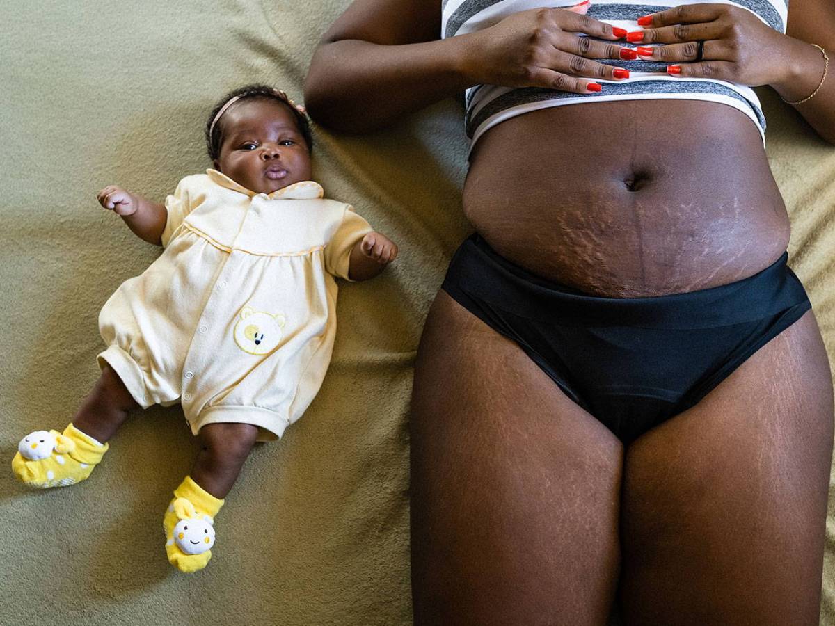 FOTOS: la vida real (y sin filtros) de mujeres después del parto