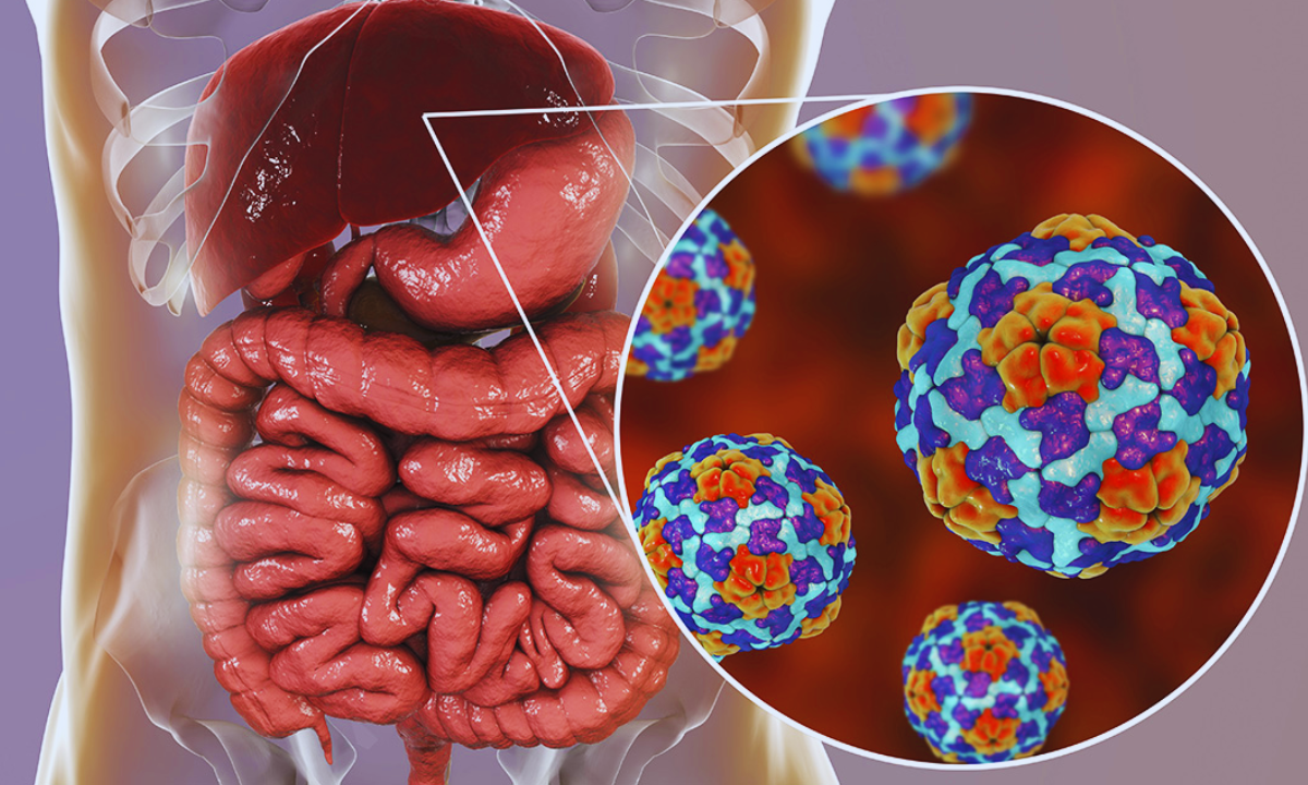 Hepatitis C: síntomas, diagnóstico y tratamiento