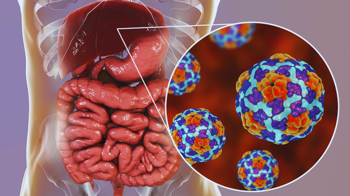 Hepatitis C: síntomas, diagnóstico y tratamiento