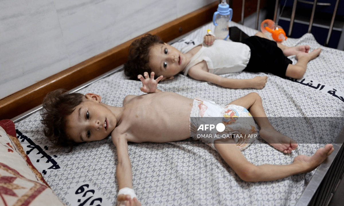 Hambruna en niños de Gaza