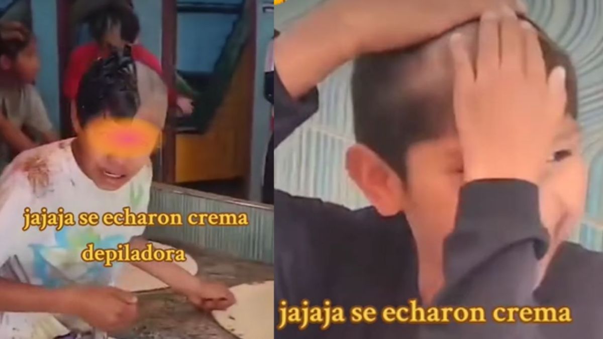 Niños quedan calvos tras echarse crema para depilar en lugar de shampoo