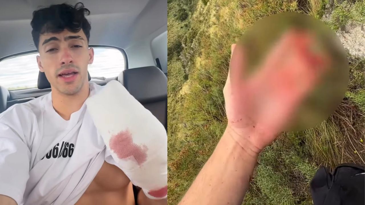 El influencer Gero Arias mostró detalles del accidente que sufrió mientras practicaba escalada, en el que perdió dos dedos de su mano. 
