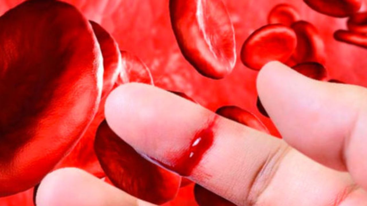 La hemofilia es conocida también como la "enfermedad de los reyes"