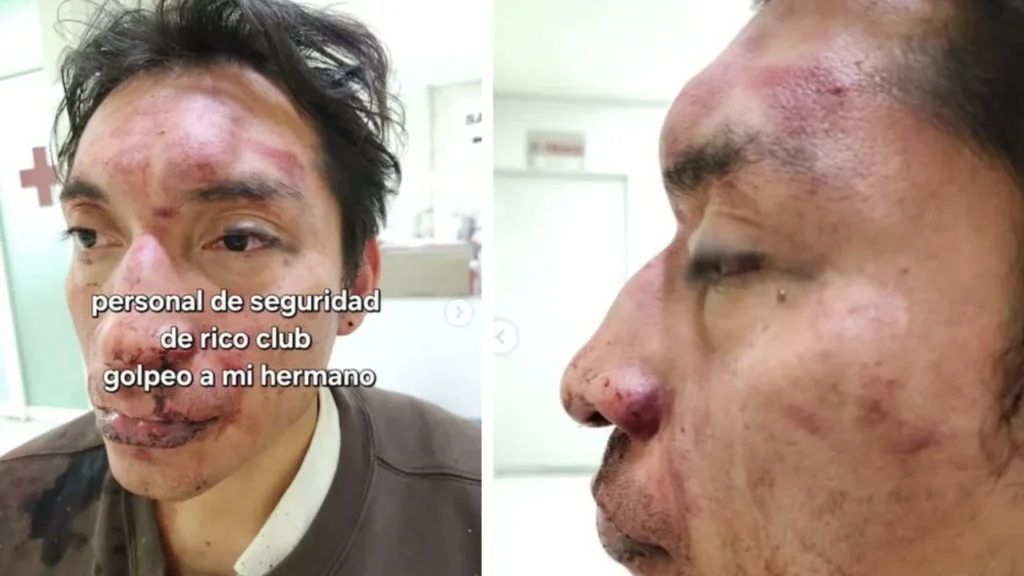 Coloca sellos de suspensión en el bar Rico, tras una nueva denuncia por agresiones hacia un cliente