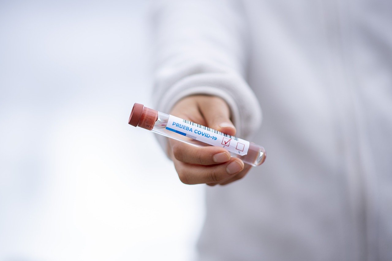 Anticuerpo Coronavirus