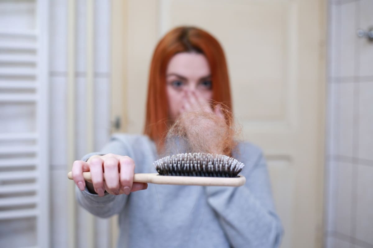 "Mi cabello se cayó en grandes mechones. Fue horrible y muy, muy perturbador"