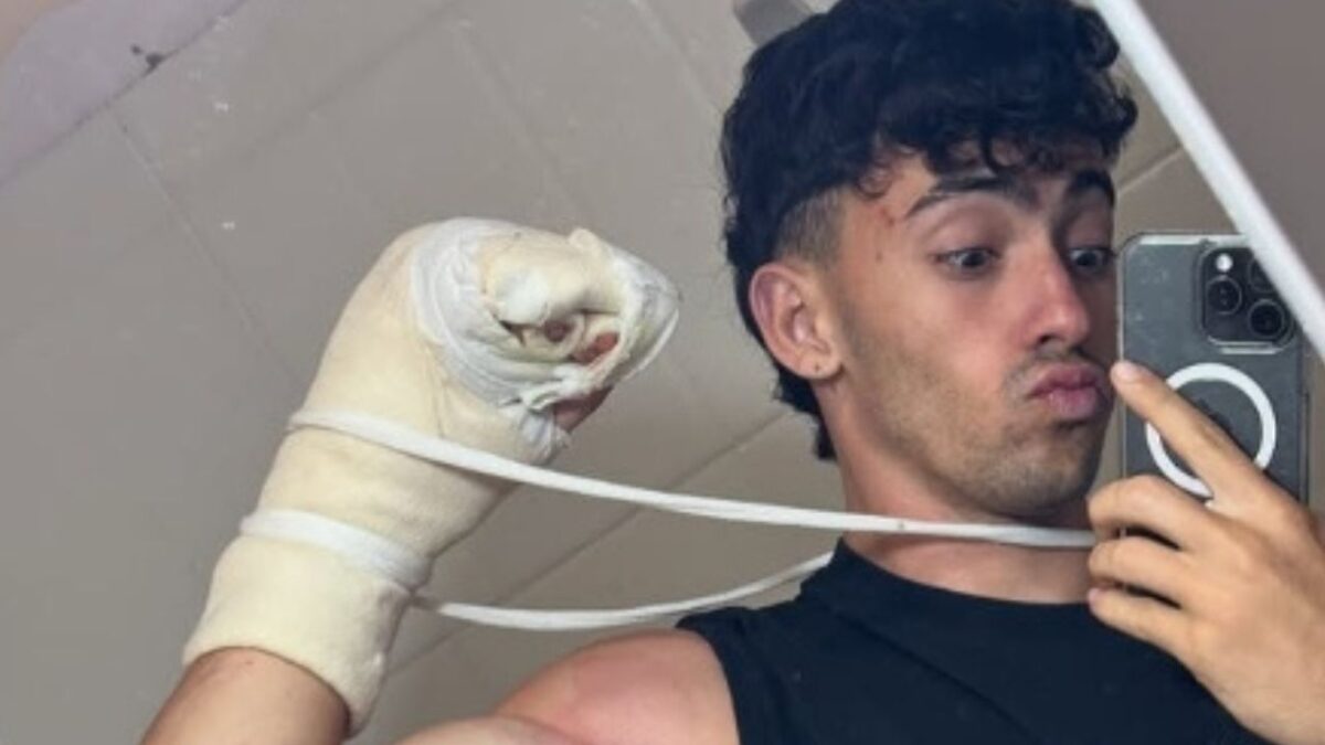 El influencer y atleta Gerónimo "Gero" Arias, perdió dos dedos de su mano por un accidente en el que cayó a un acantilado de 10 metros.