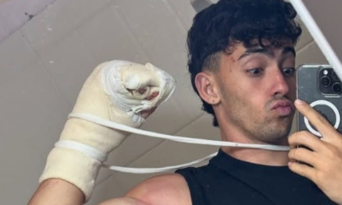El influencer y atleta Gerónimo "Gero" Arias, perdió dos dedos de su mano por un accidente en el que cayó a un acantilado de 10 metros.