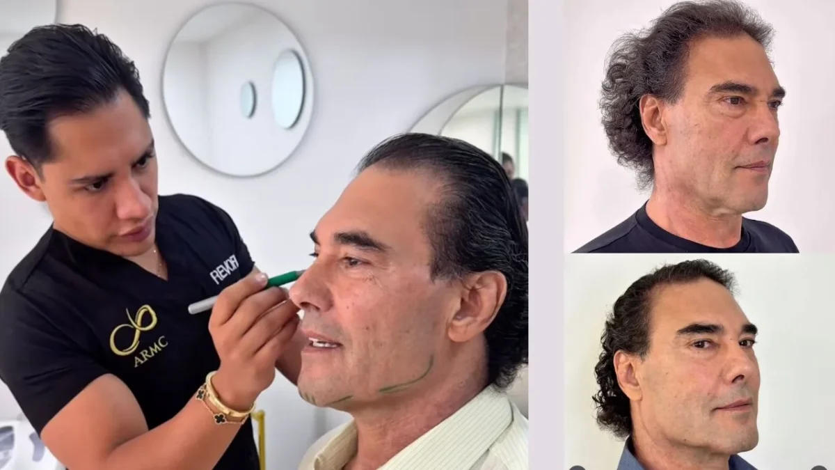 Algunos usuarios en redes sociales elogiaron el nuevo rostro de Eduardo Yañez tras someterse a tratamientos para mejorar su apariencia.