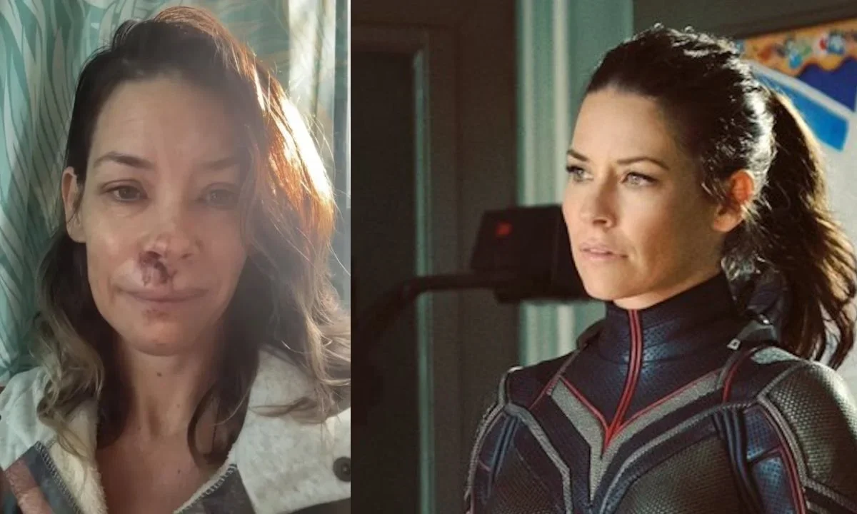Evangeline Lilly, actriz de Marvel, revela que tiene daño cerebral tras contusión