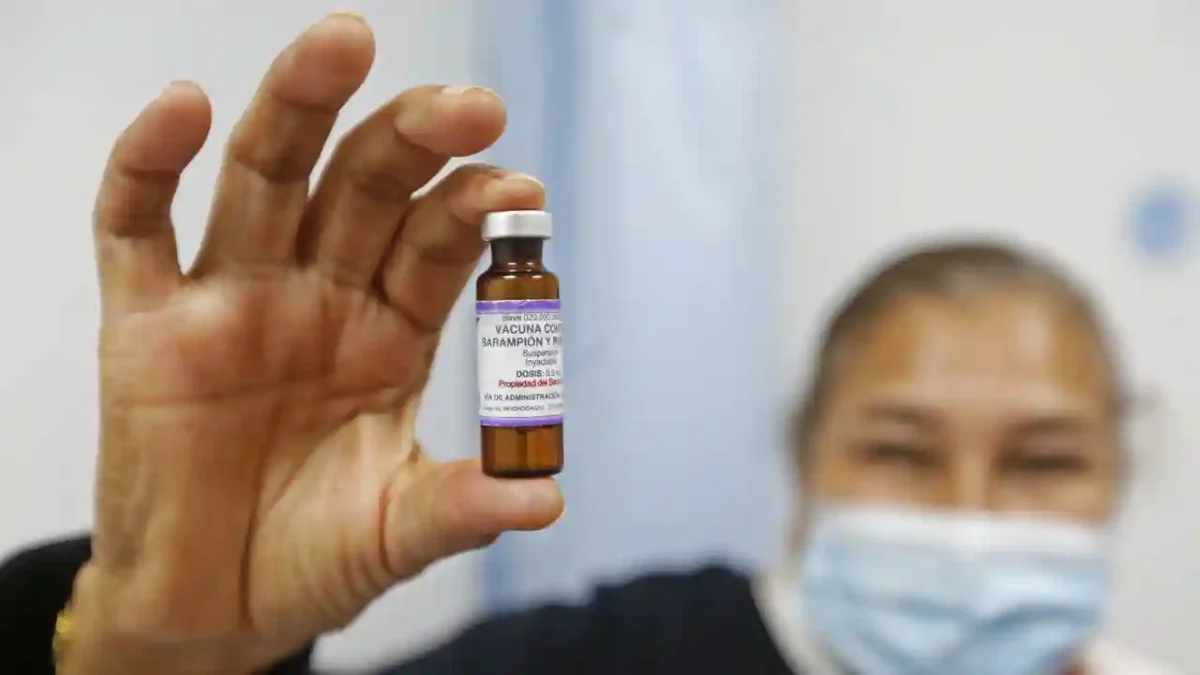 Secretaría de Salud, David Kershenobich sarampión