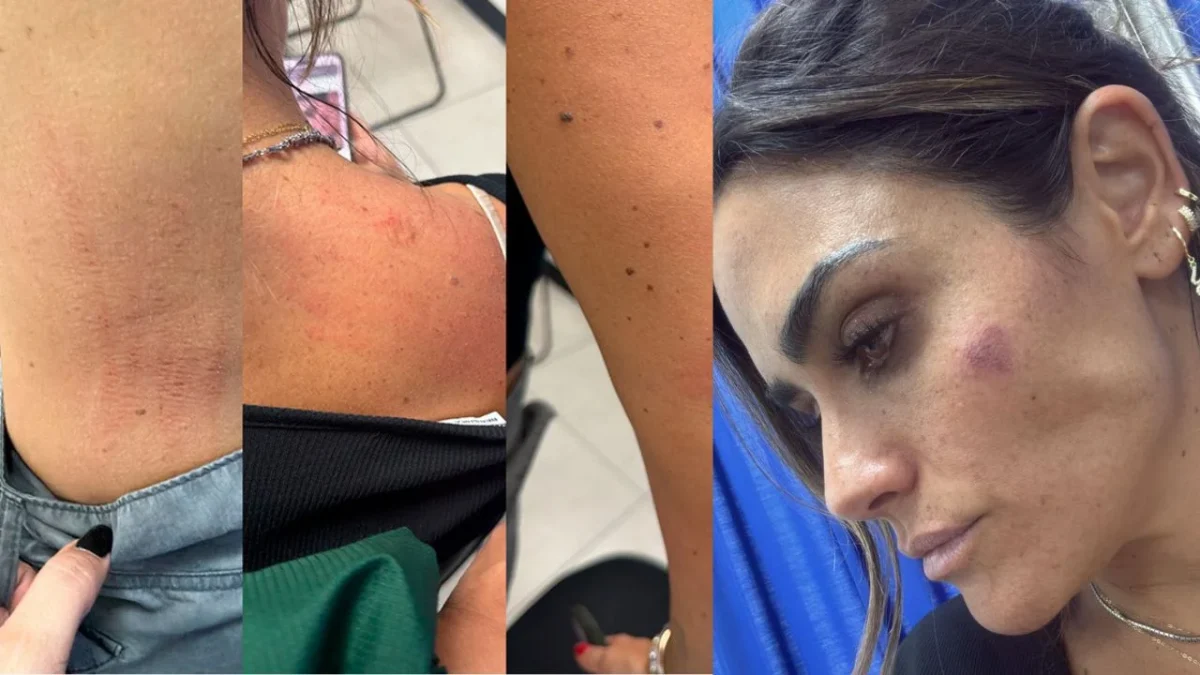 Alessandra Rojo de la Vega denuncia agresión tras operativo en San Cosme