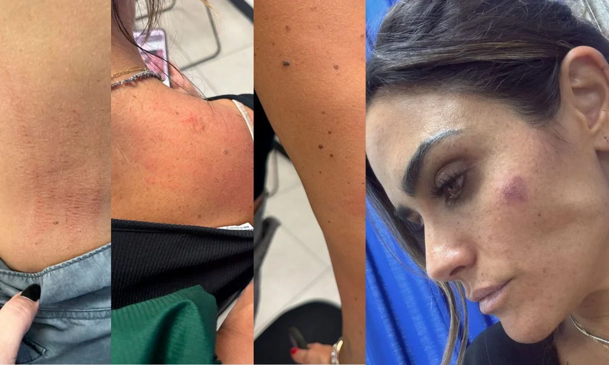 Alessandra Rojo de la Vega denuncia agresión tras operativo en San Cosme