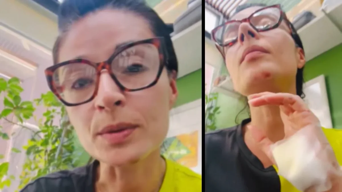 La diputada federal, Laura Ballesteros, sufrió un accidente en bicicleta el día de hoy y tuvo que ser trasladada al hospital.