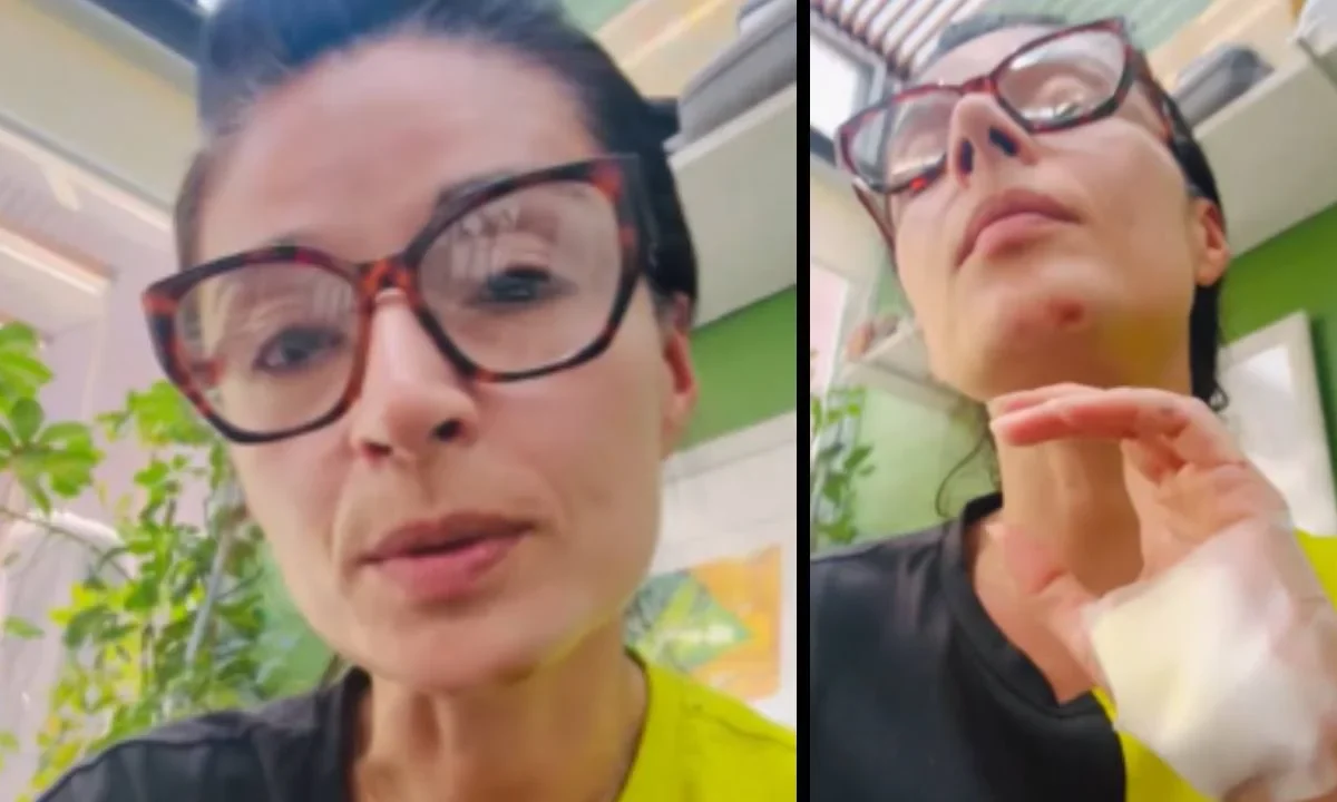 La diputada federal, Laura Ballesteros, sufrió un accidente en bicicleta el día de hoy y tuvo que ser trasladada al hospital.