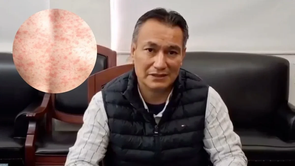 La Secretaría de Salud de Durango confirmó la primera muerte por sarampión en 2026, se trata de un niño de ocho años.