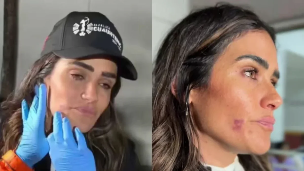 Alessandra Rojo de la Vega denunció agresiones físicas contra ella y su equipo de trabajo, presentará denuncias contra agresores.