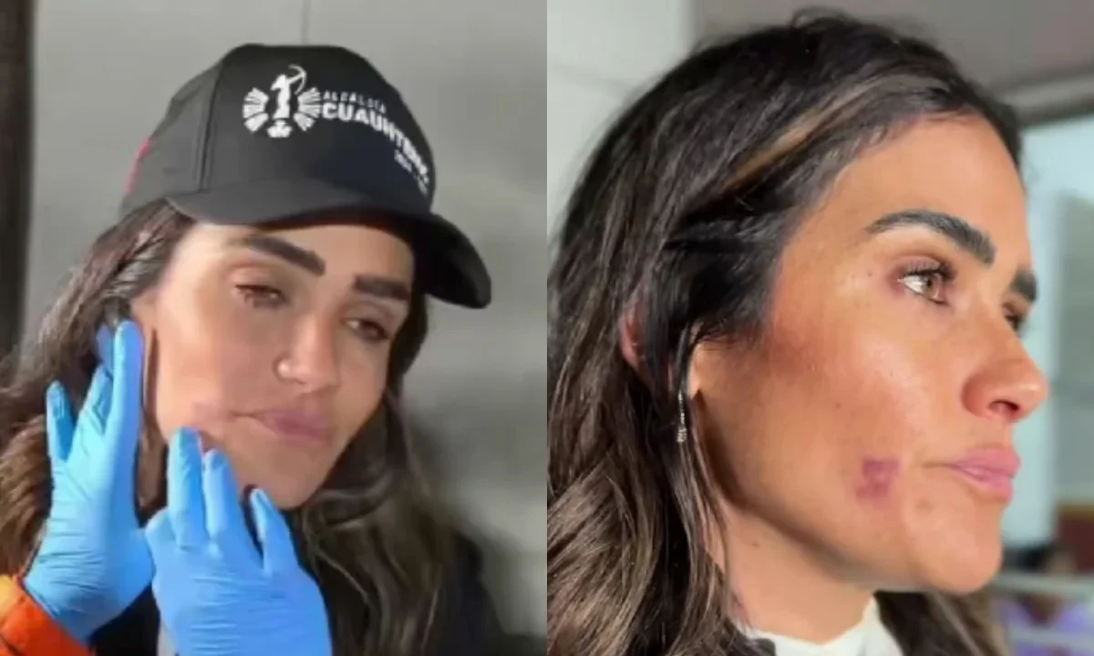 Alessandra Rojo de la Vega denunció agresiones físicas contra ella y su equipo de trabajo, presentará denuncias contra agresores.
