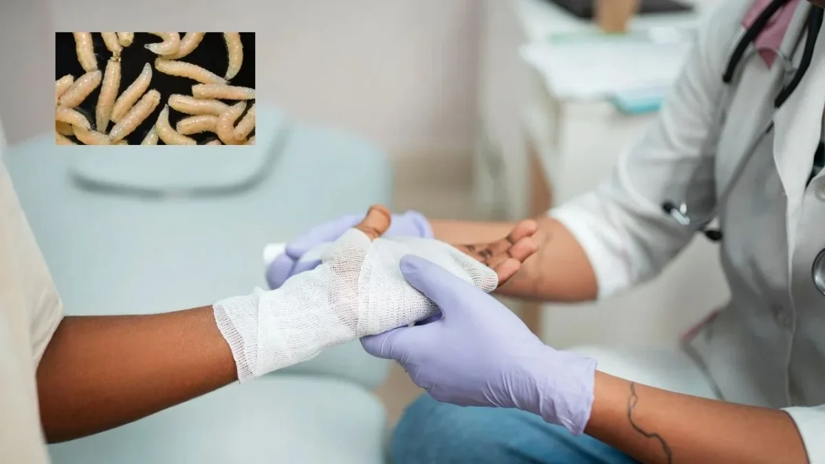 El número total de personas diagnosticadas con miasis por gusano barrenador en Nuevo León ascendería a tres en lo que va del 2026. 