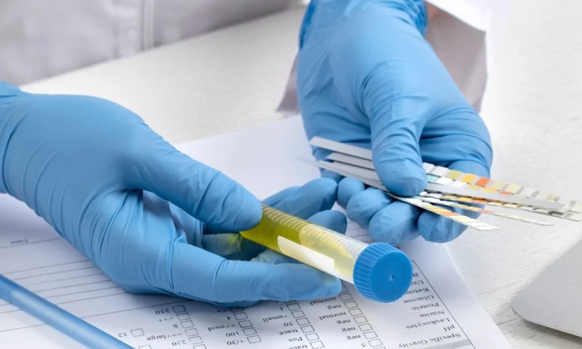 Conoce qué estudios de laboratorio puedes solicitar en caso de tener relaciones sexuales de riesgo y sospechar el contagio de alguna ITS.